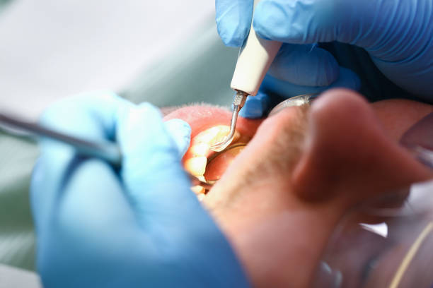 Best Emergency Dentist for Knocked-Out Tooth in Ardmore, TN