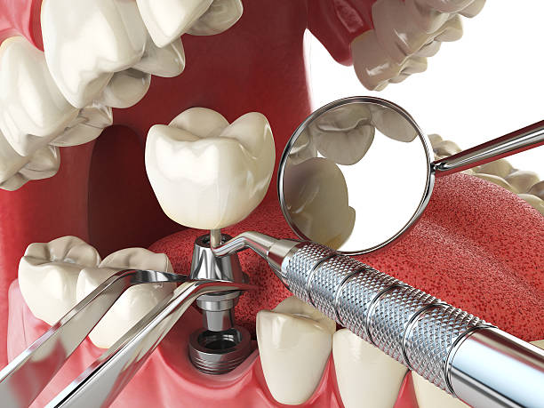 Best Emergency Dental Extractions in Ardmore, TN